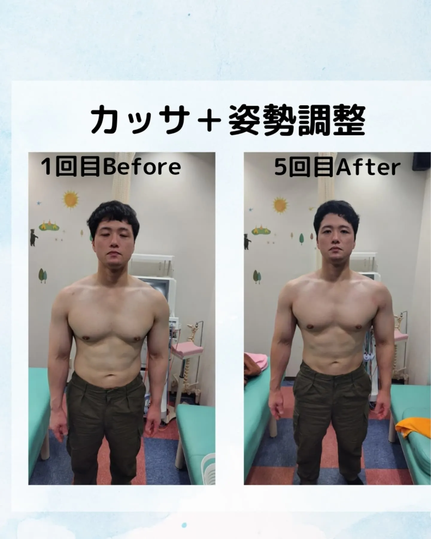 姿勢調整＋純銀カッサのBefore.After