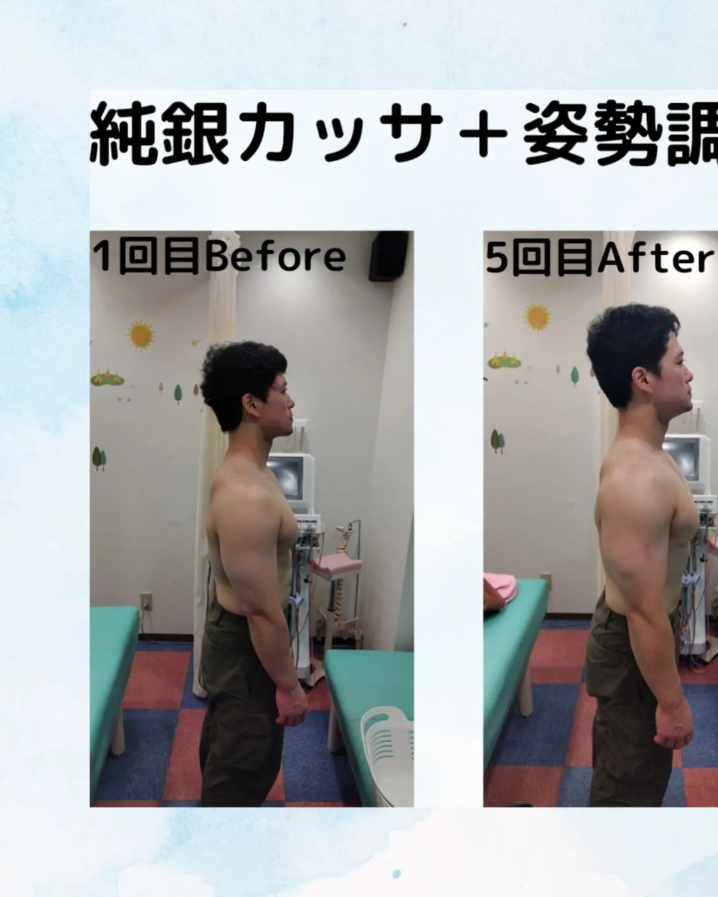 姿勢調整＋純銀カッサのBefore.After